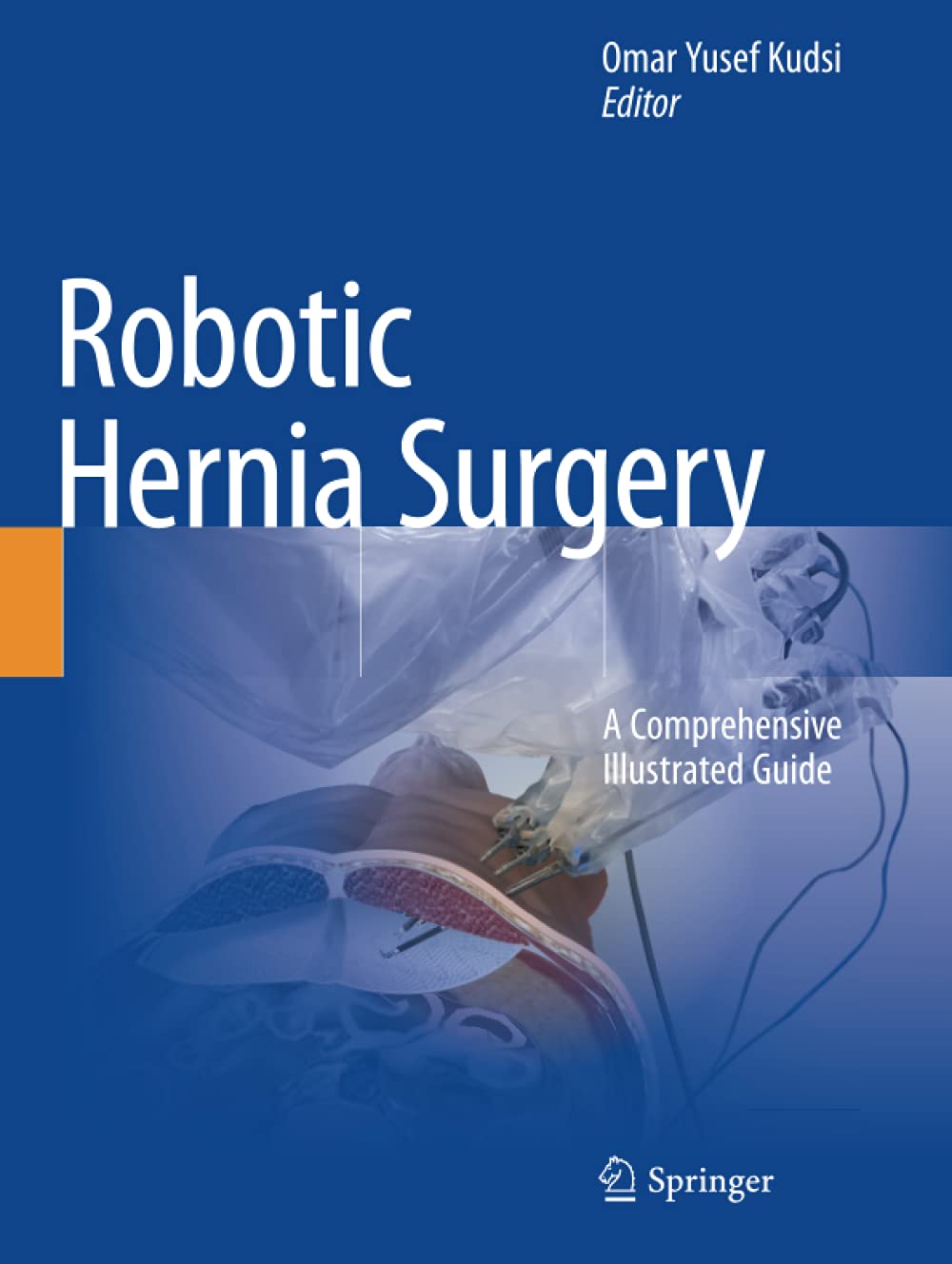 Coperta cărții "Robotic Hernia Surgery: A Comprehensive Illustrated Guide" de autor necunoscut