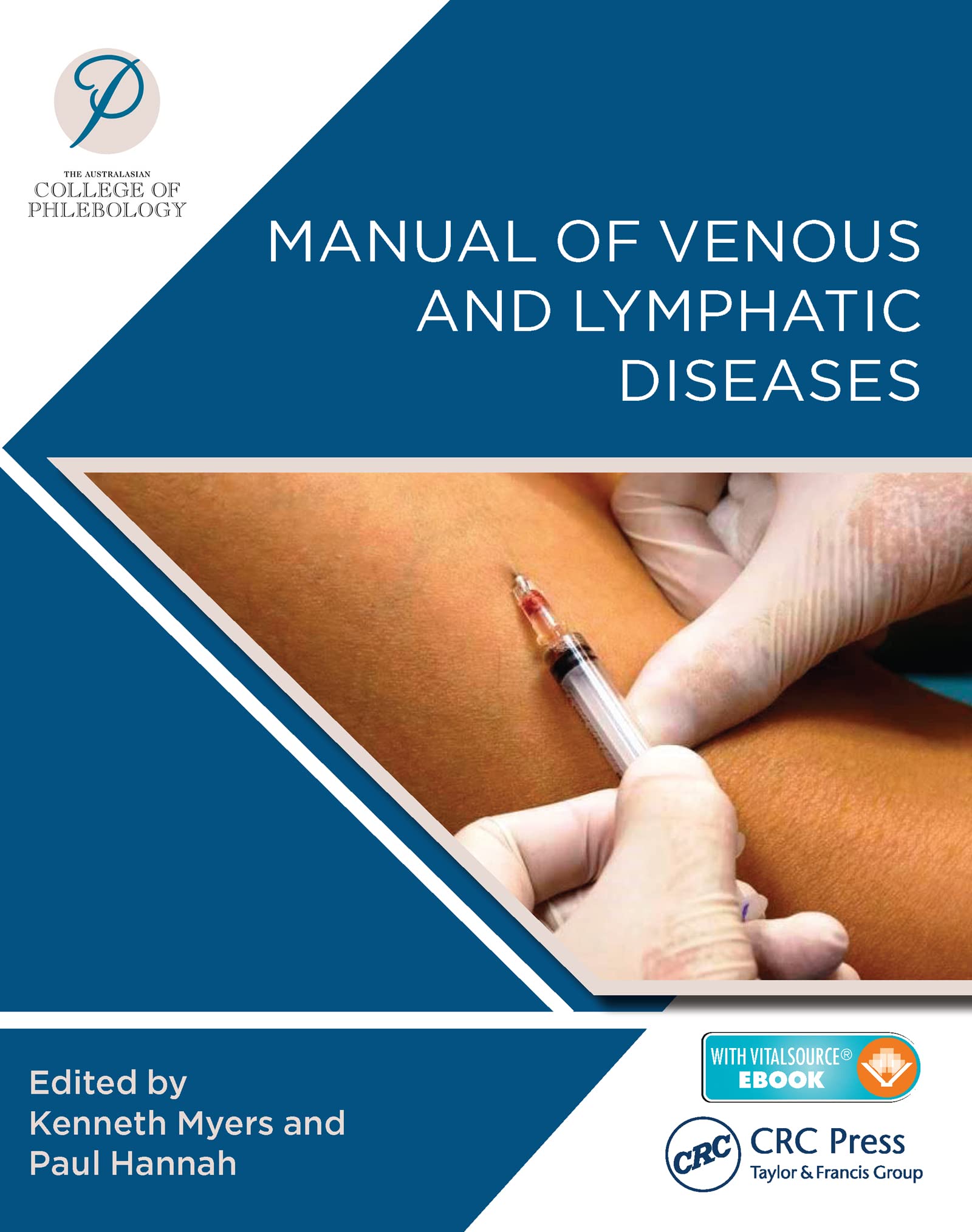 Coperta cărții "Manual of Venous and Lymphatic Diseases" de autor necunoscut