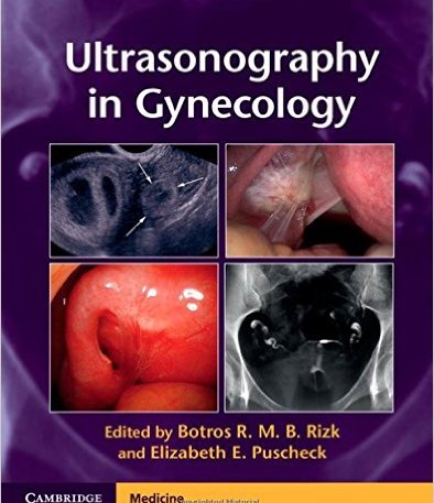 Coperta cărții "Ultrasonography in Gynecology" de autor necunoscut