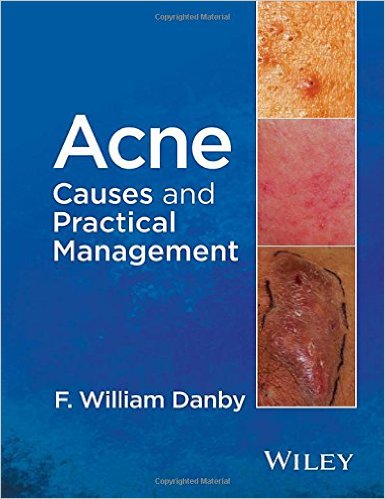 Coperta cărții "Acne: Causes and Practical Management 1st Edition" de autor necunoscut