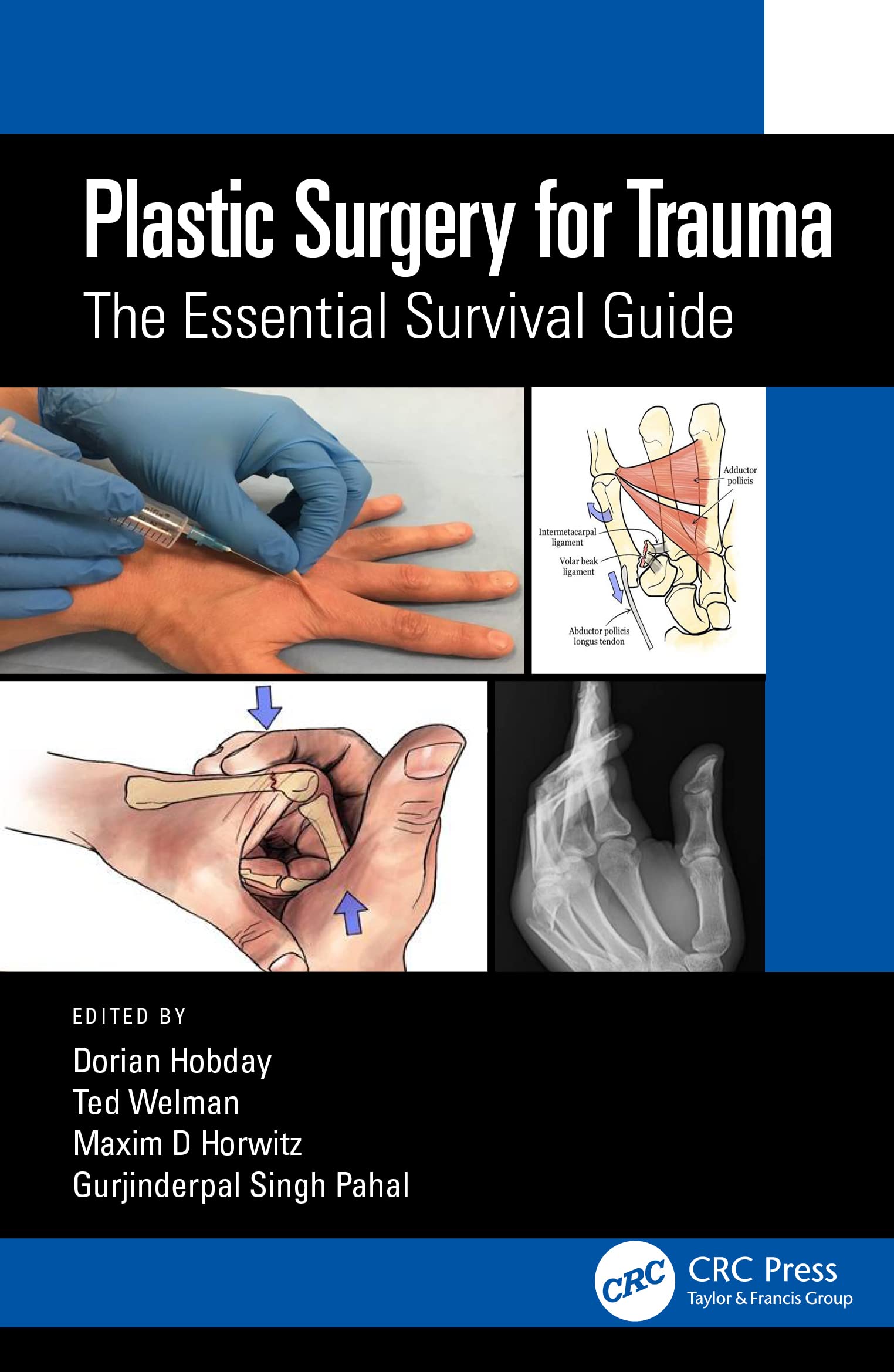 Coperta cărții "Plastic Surgery for Trauma: The Essential Survival Guide" de autor necunoscut