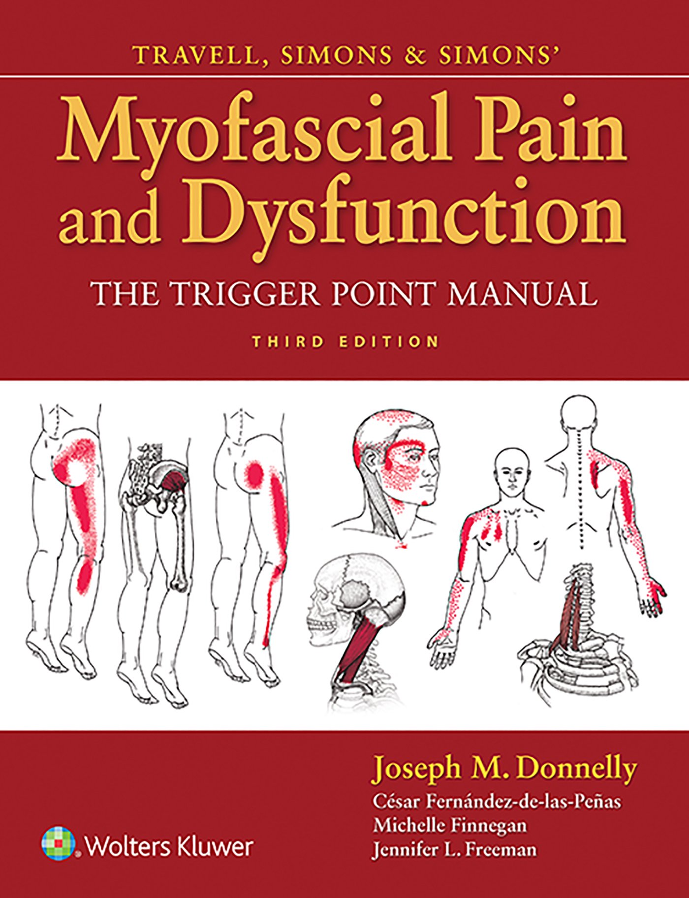 Coperta cărții "Travell and Simons&amp;#146; Myofascial Pain and Dysfunction: The Trigger Point Manual" de autor necunoscut