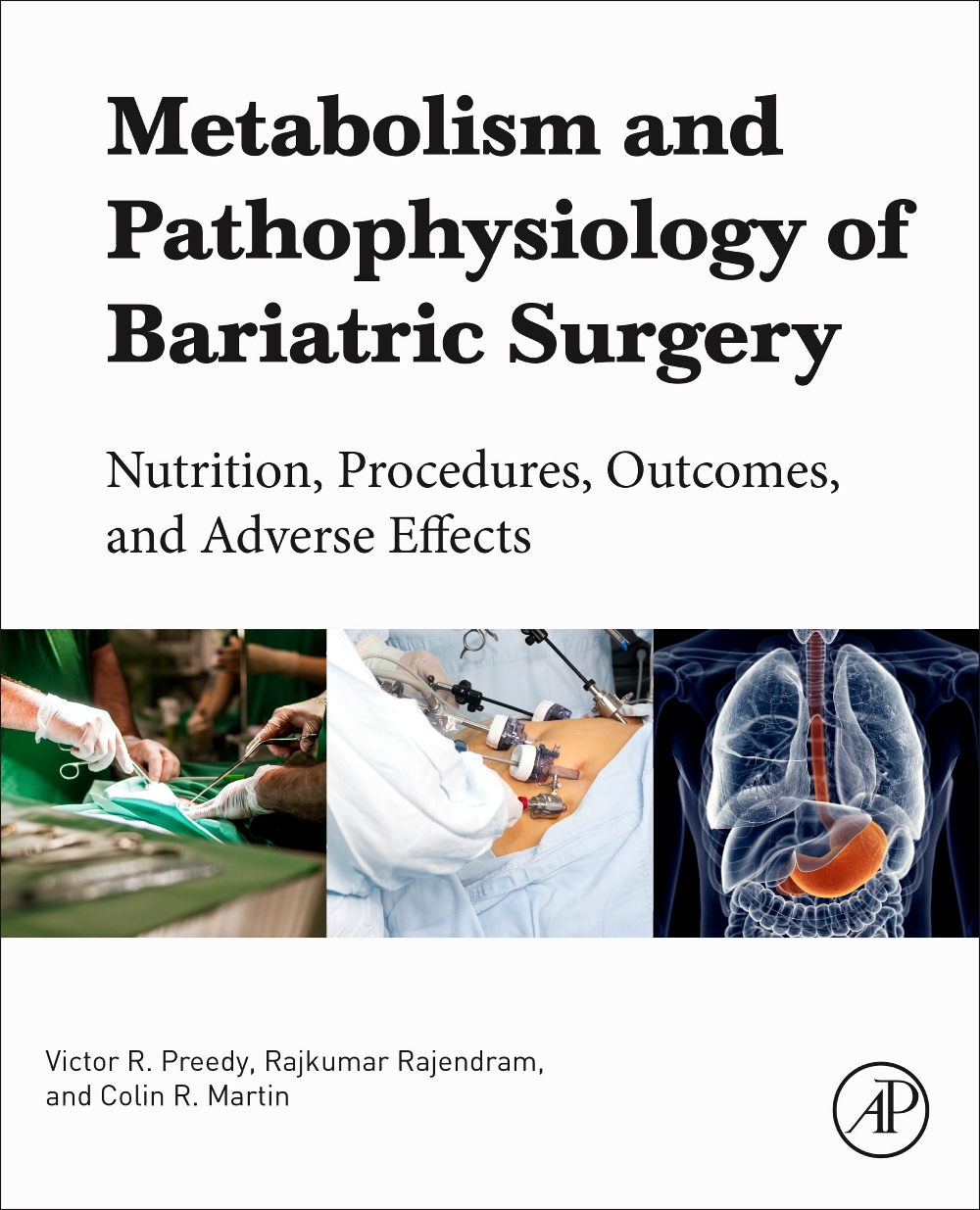 Coperta cărții "Metabolism and Pathophysiology of Bariatric Surgery: Nutrition Procedures, Outcomes and Adverse Effects" de autor necunoscut