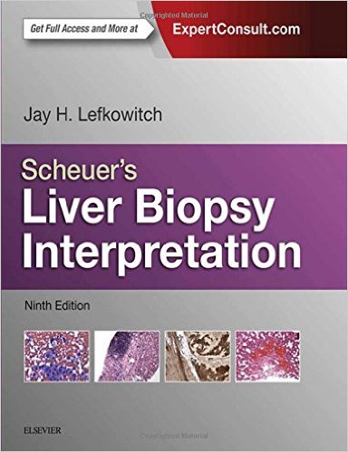 Coperta cărții "Scheuer&amp;#146;s Liver Biopsy Interpretation, 9e" de autor necunoscut