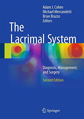 Coperta cărții "The Lacrimal System  Diagnosis, Management, and Surgery, Second Edition" de autor necunoscut