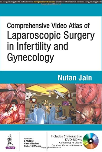 Coperta cărții "Comprehensive Video Atlas of Laparoscopic Surgery in Infertility and Gynecology" de autor necunoscut