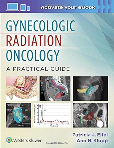 Coperta cărții "Gynecologic Radiation Oncology: A Practical Guide" de autor necunoscut