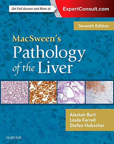Coperta cărții "MacSween&amp;#146;s Pathology of the Liver, 7th Edition" de autor necunoscut