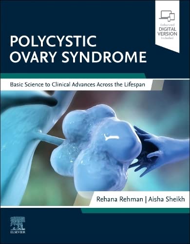 Coperta cărții "Polycystic Ovary Syndrome" de autor necunoscut
