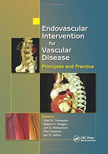 Coperta cărții "Endovascular Intervention for Vascular Disease" de autor necunoscut