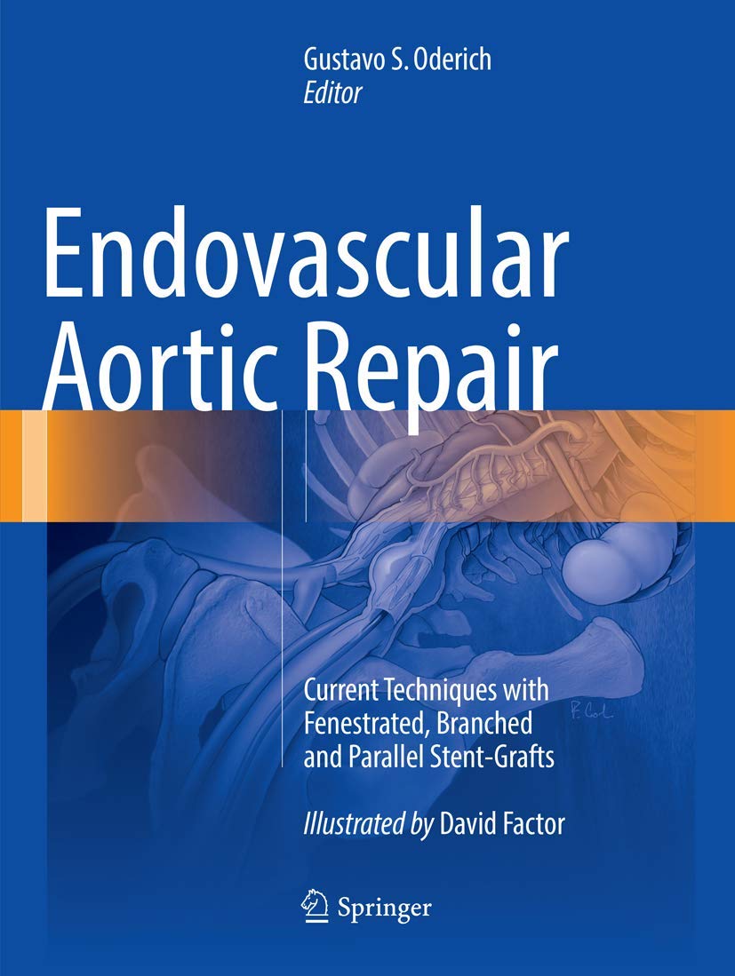 Coperta cărții "Endovascular Aortic Repair: Current Techniques with Fenestrated, Branched and Parallel Stent-Grafts" de autor necunoscut