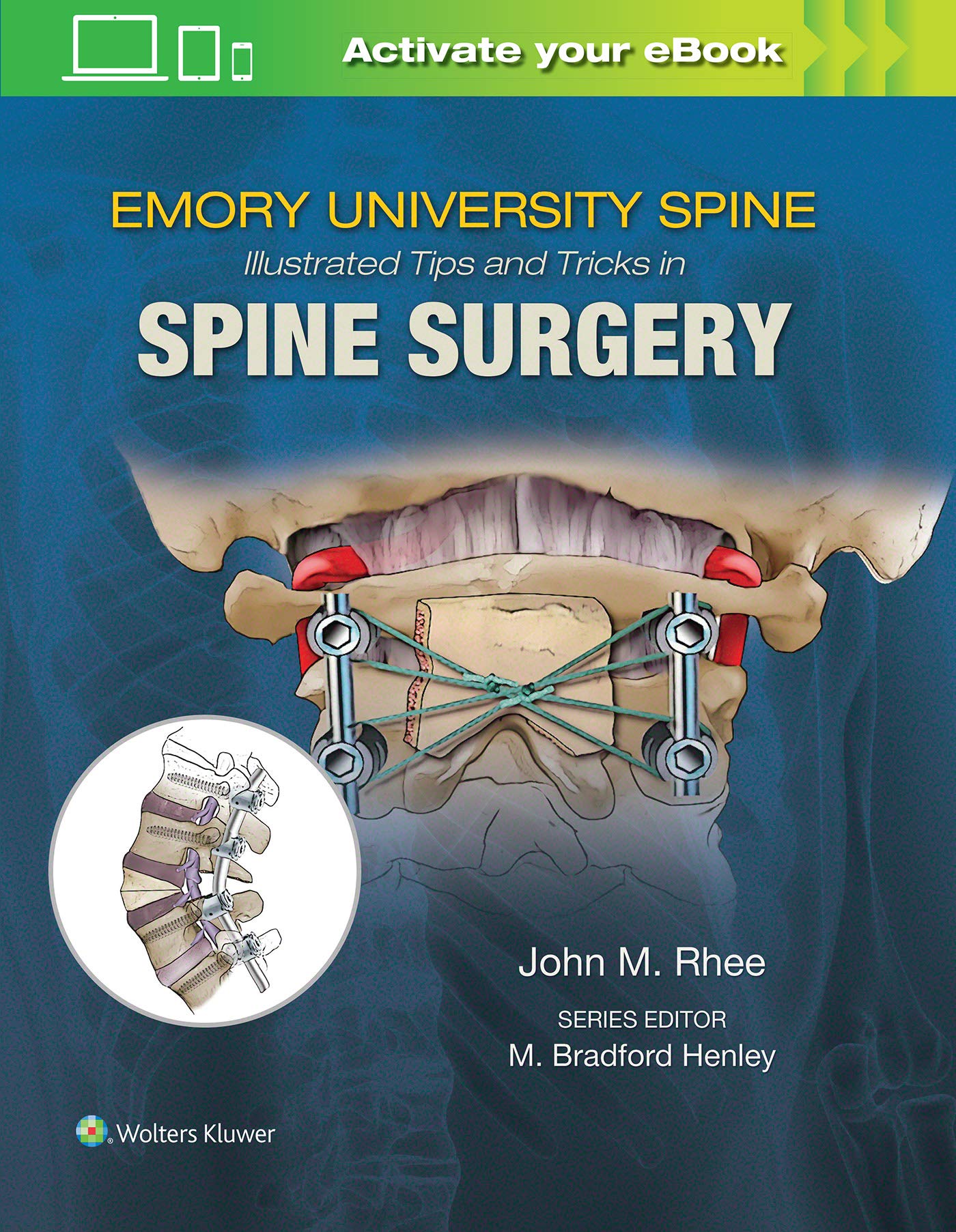Coperta cărții "Emory&amp;#146;s Illustrated Tips and Tricks in Spine Surgery" de autor necunoscut