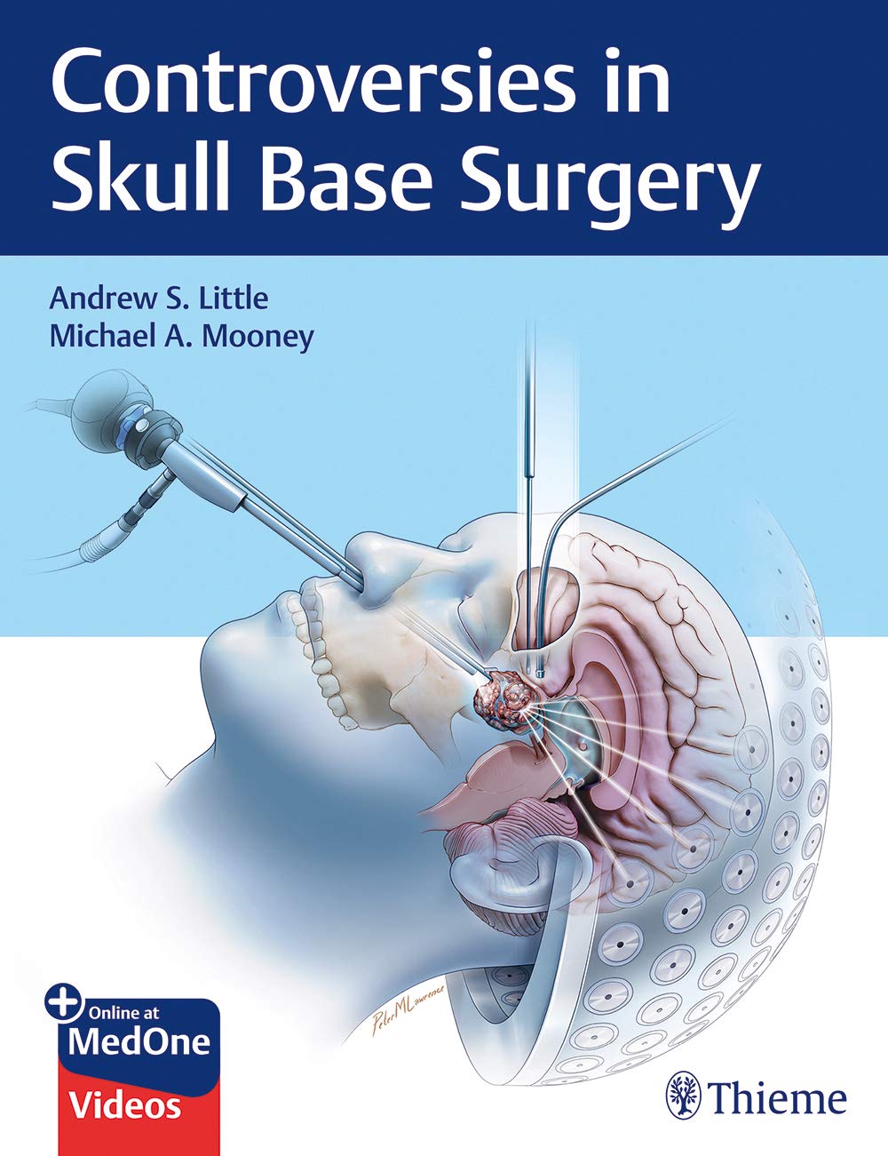 Coperta cărții "Controversies in Skull Base Surgery" de autor necunoscut
