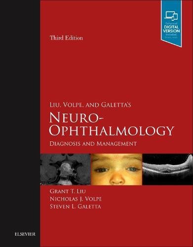 Coperta cărții "Liu, Volpe, and Galetta&#039;s Neuro-Ophthalmology: Diagnosis and Management, 3e" de autor necunoscut