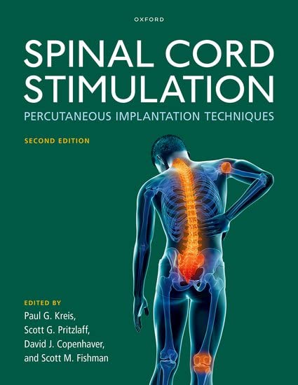 Coperta cărții "Spinal Cord Stimulation: Percutaneous Implantation Techniques" de autor necunoscut