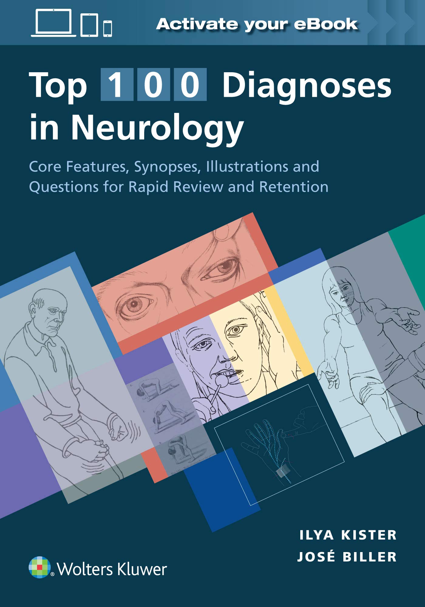 Coperta cărții "Top 100 Diagnoses in Neurology" de autor necunoscut