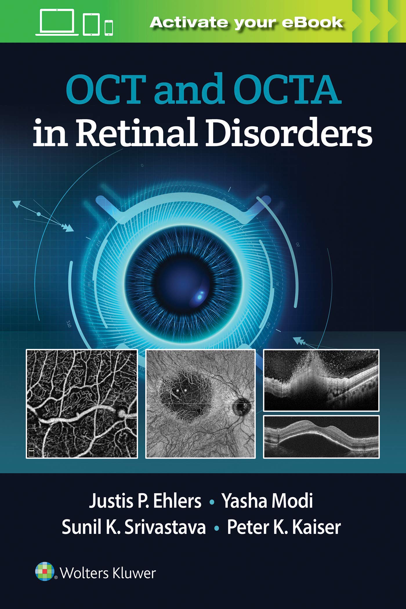 Coperta cărții "OCT and OCTA Angiography in Retinal Disorders" de autor necunoscut