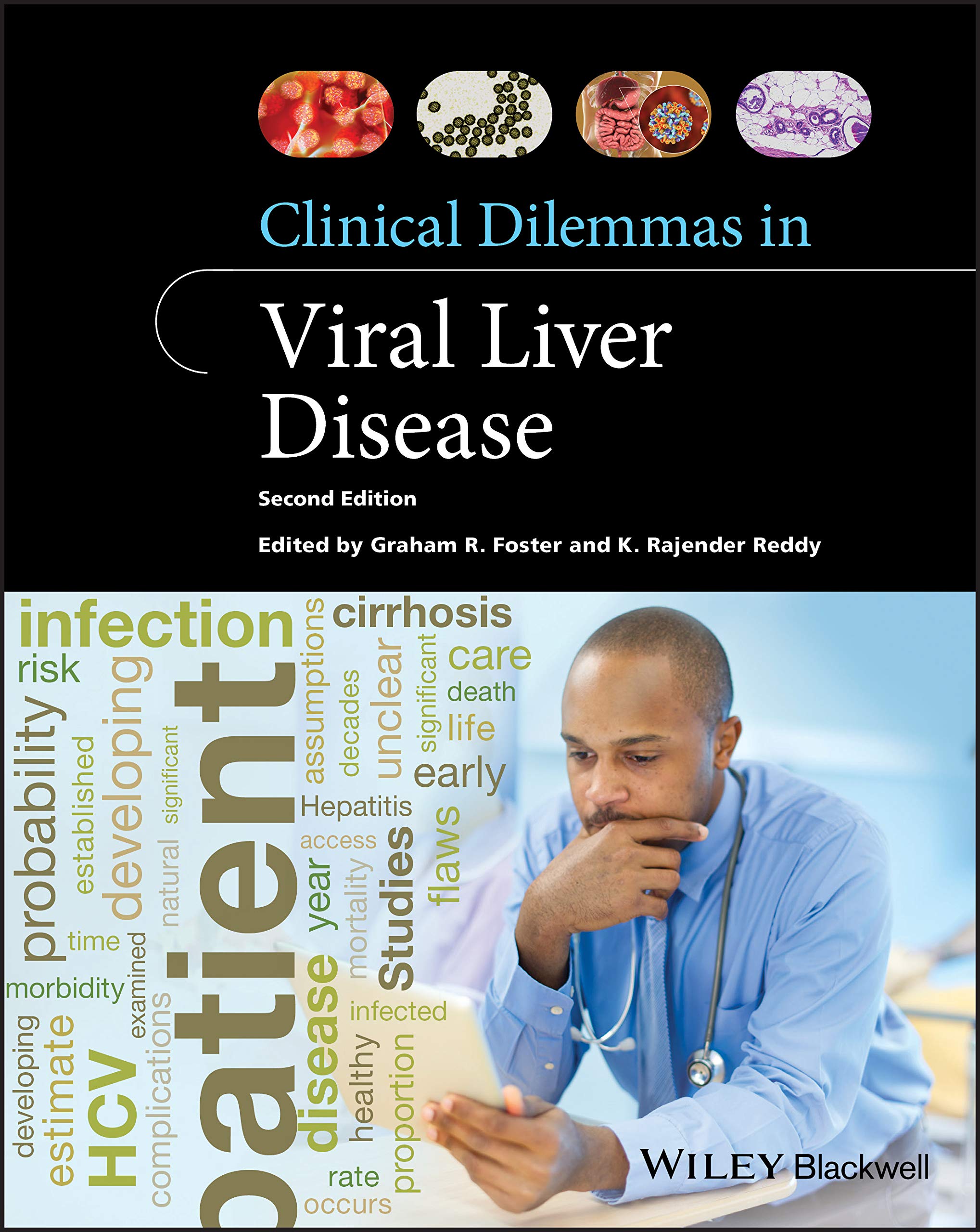 Coperta cărții "Clinical Dilemmas in Viral Liver Disease" de autor necunoscut