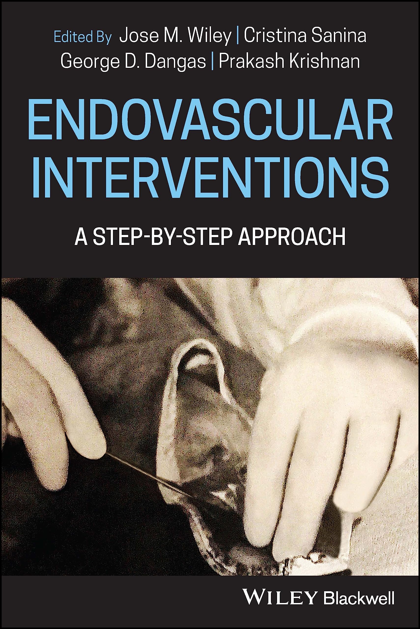 Coperta cărții "Endovascular Procedures A Step&amp;#150;by&amp;#150;Step Approach" de autor necunoscut