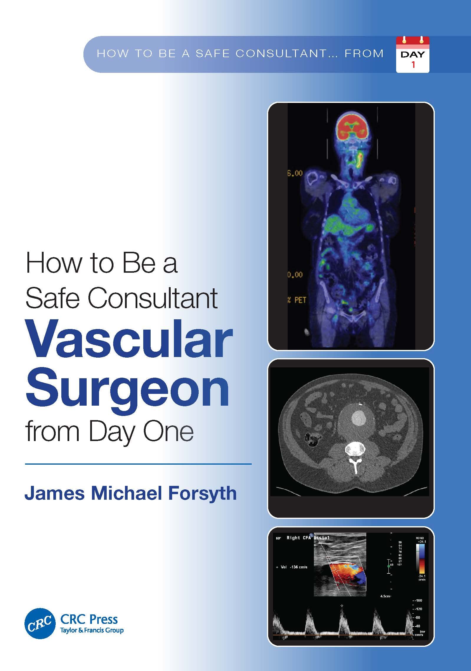 Coperta cărții "How to be a Safe Consultant Vascular Surgeon from Day One" de autor necunoscut