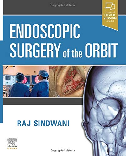 Coperta cărții "Endoscopic Surgery of the Orbit" de autor necunoscut
