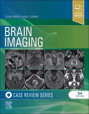 Coperta cărții "Brain Imaging: Case Review Series" de autor necunoscut