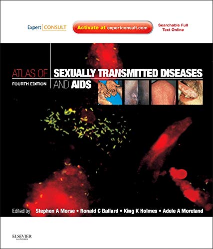 Coperta cărții "Atlas of Sexually Transmitted Diseases and AIDS, Expert Consult, 4th Edition" de autor necunoscut