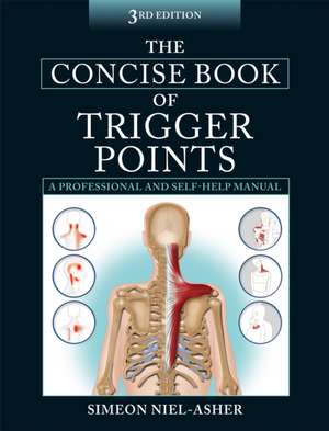 Coperta cărții "Concise Book of Trigger Points 3rd" de autor necunoscut