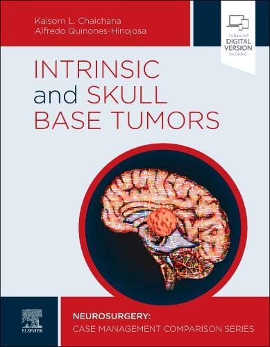 Coperta cărții "Intrinsic and Skull Base Tumors: Neurosurgery: Case Management Comparison Series" de autor necunoscut