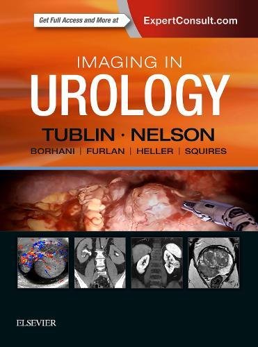 Coperta cărții "Imaging in Urology, 1e" de autor necunoscut