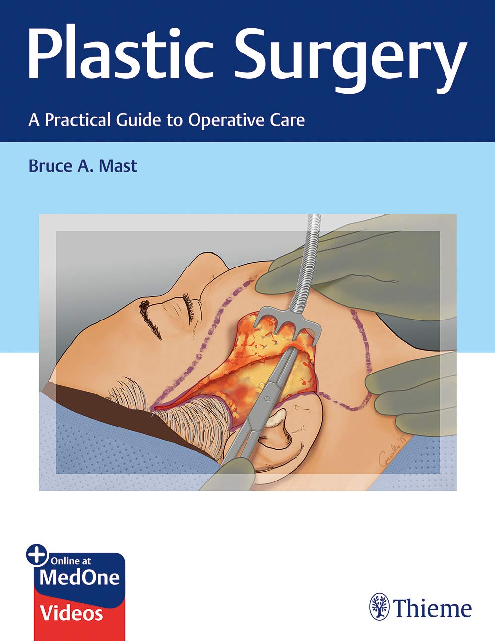 Coperta cărții "Plastic Surgery: A Practical Guide to Operative Care: A Practical Guide to Patient Care" de autor necunoscut