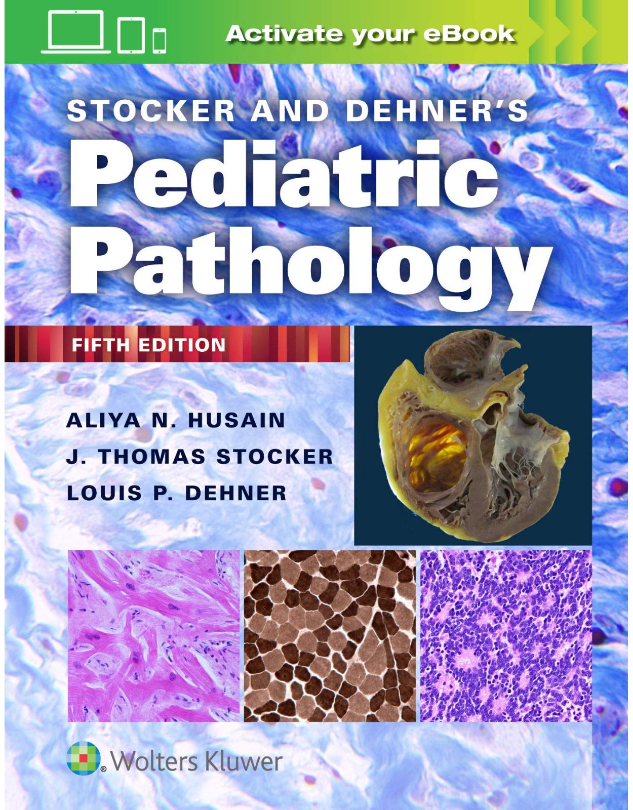 Stocker and Dehner’s Pediatric Pathology