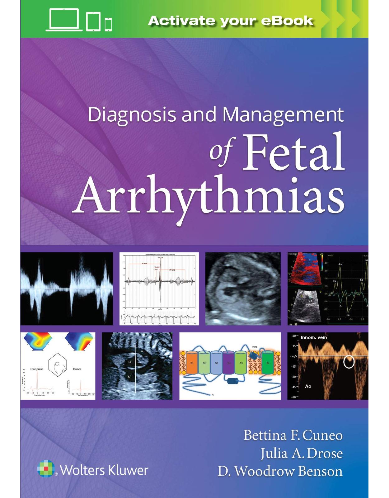 Diagnosis and Management of Fetal Arrhythmias 