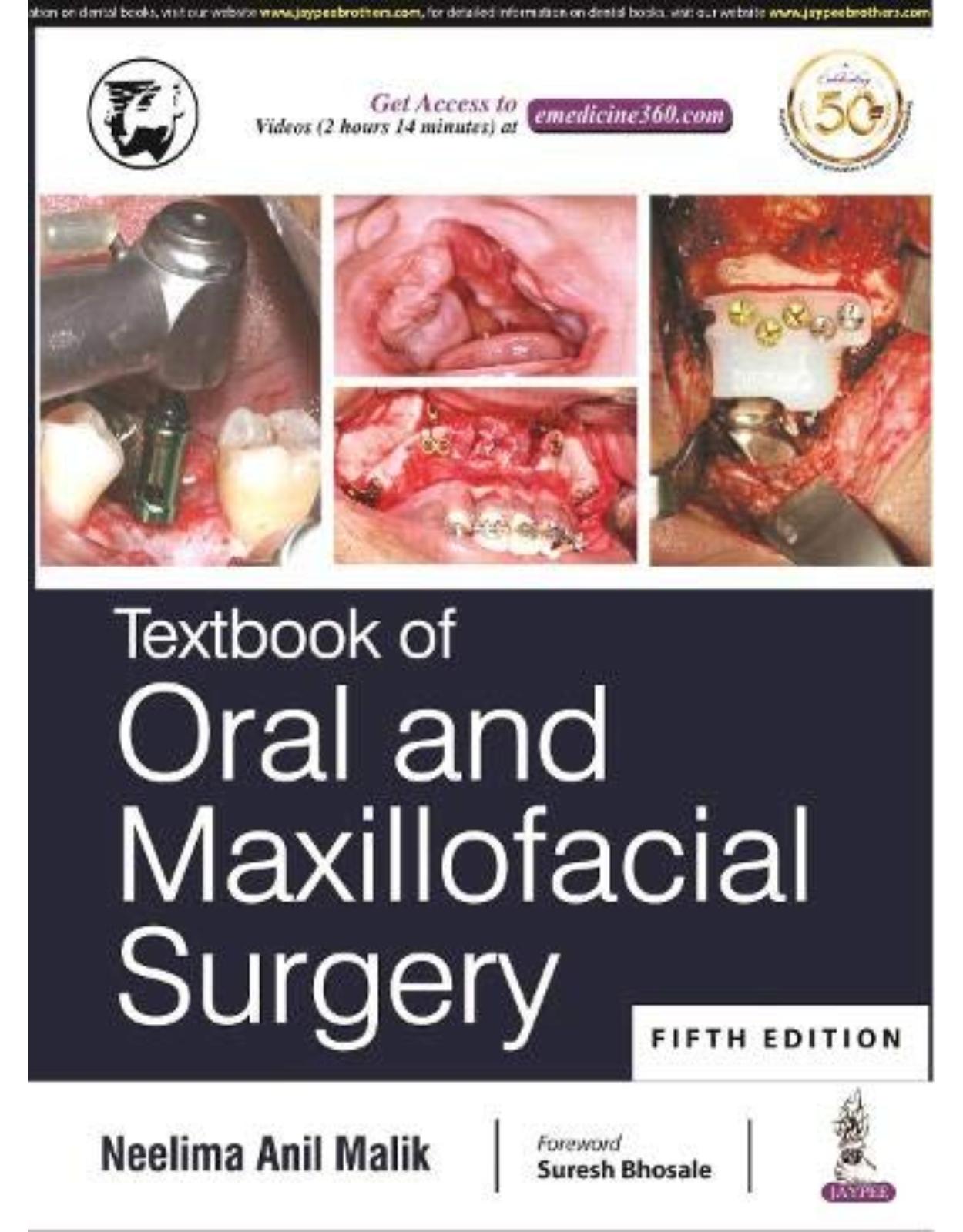 Textbook of Oral and Maxillofacial Surgery
