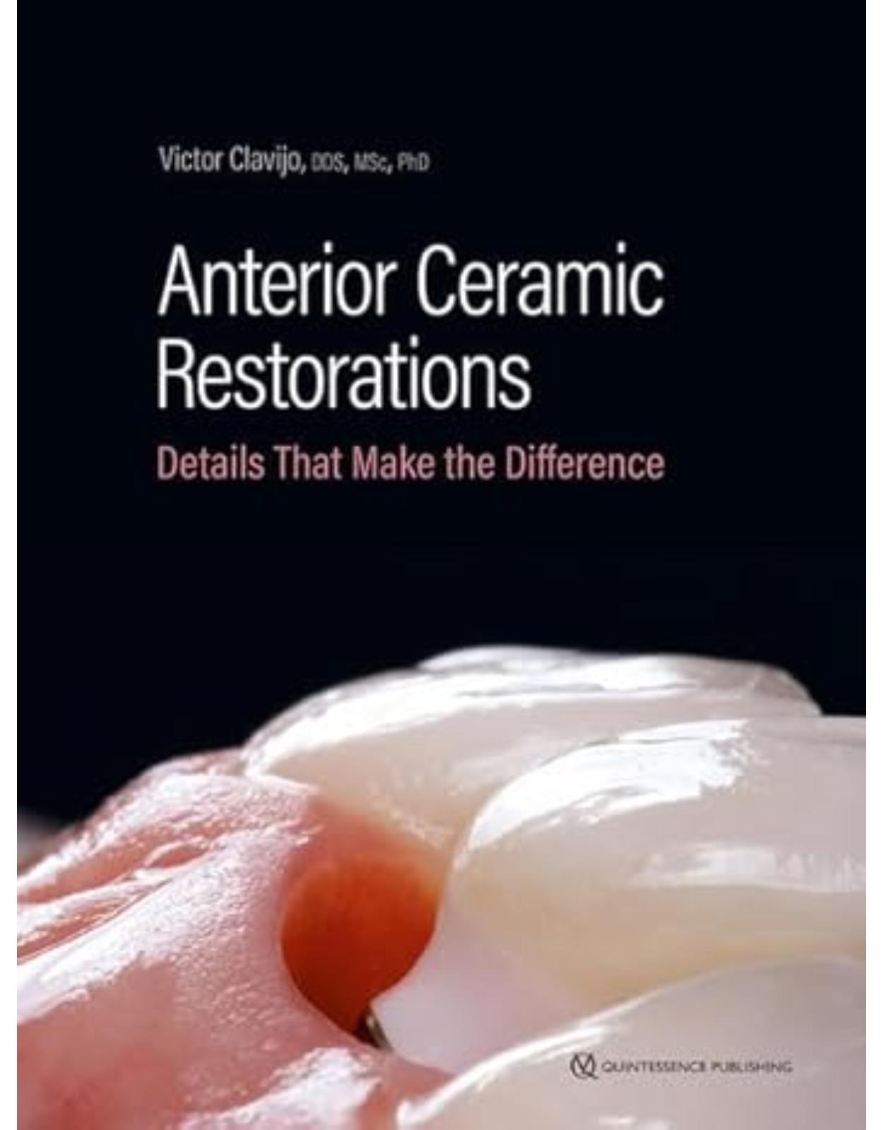 Anterior Ceramic Restorations: Details That Make the Difference
