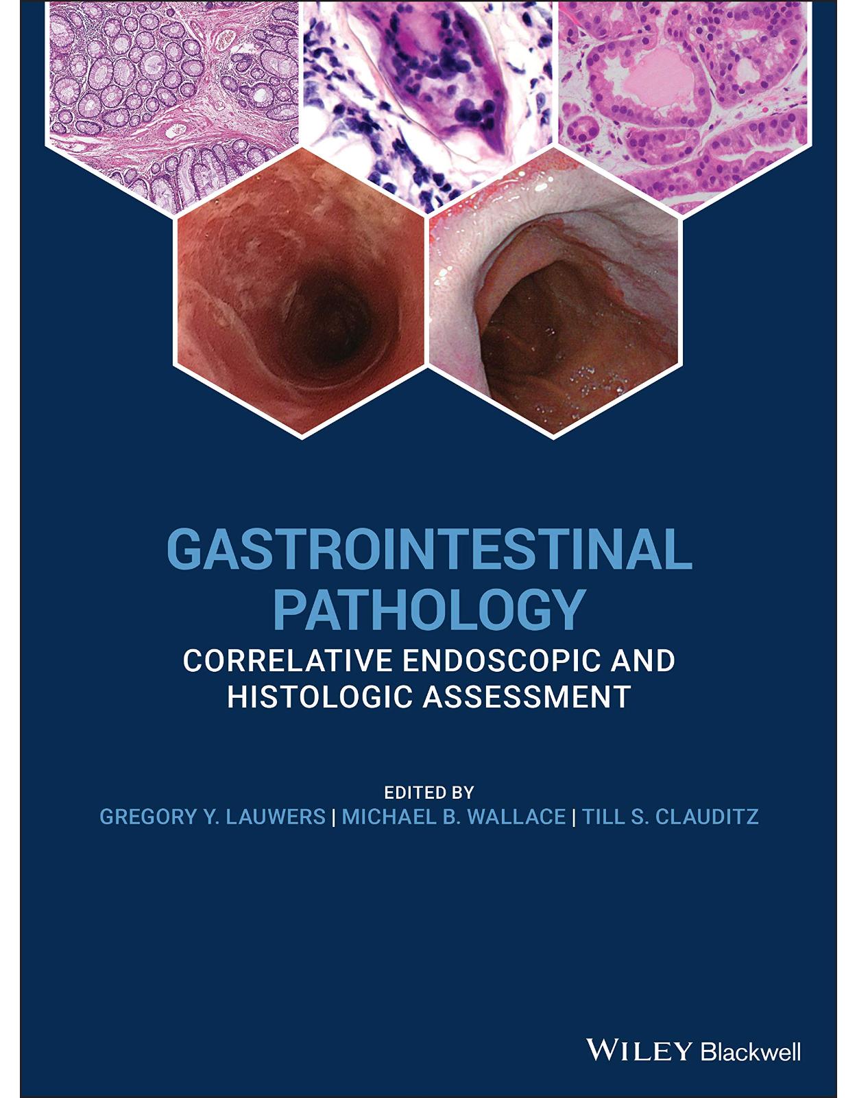 Gastrointestinal Pathology: Correlative Endoscopic and Histologic Assessment 