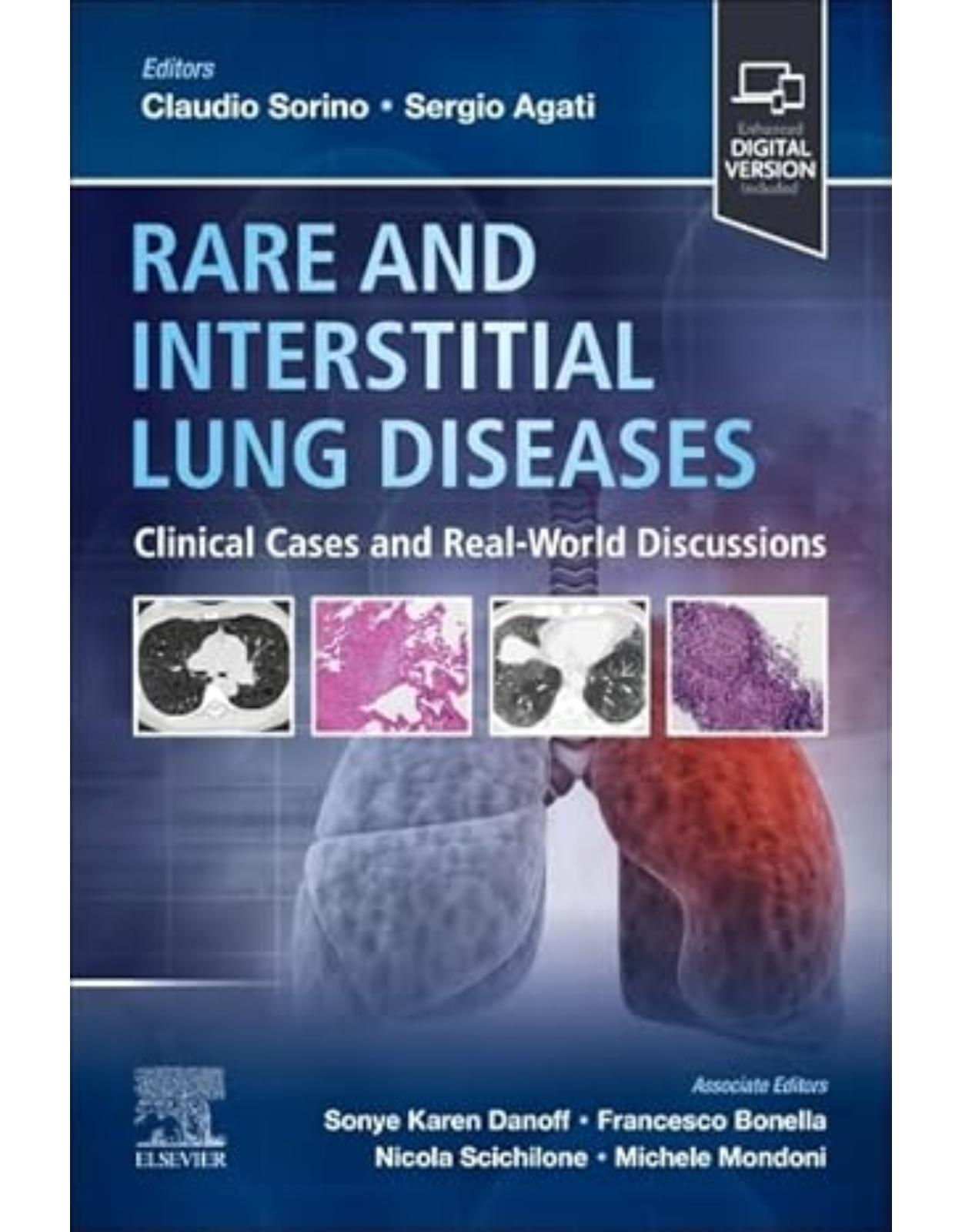 Rare and Interstitial Lung Diseases, 1st Edition