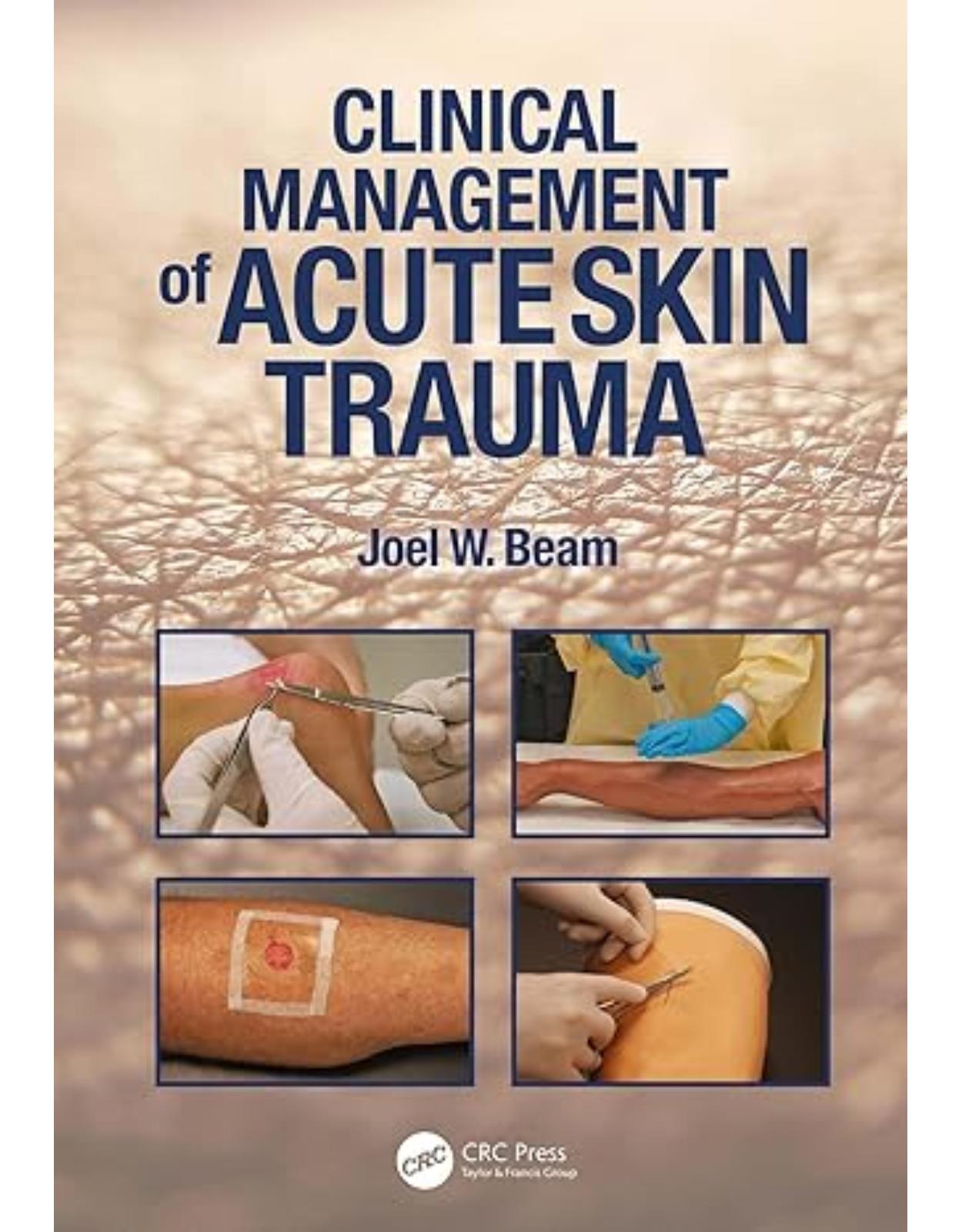 Clinical Management of Acute Skin Trauma