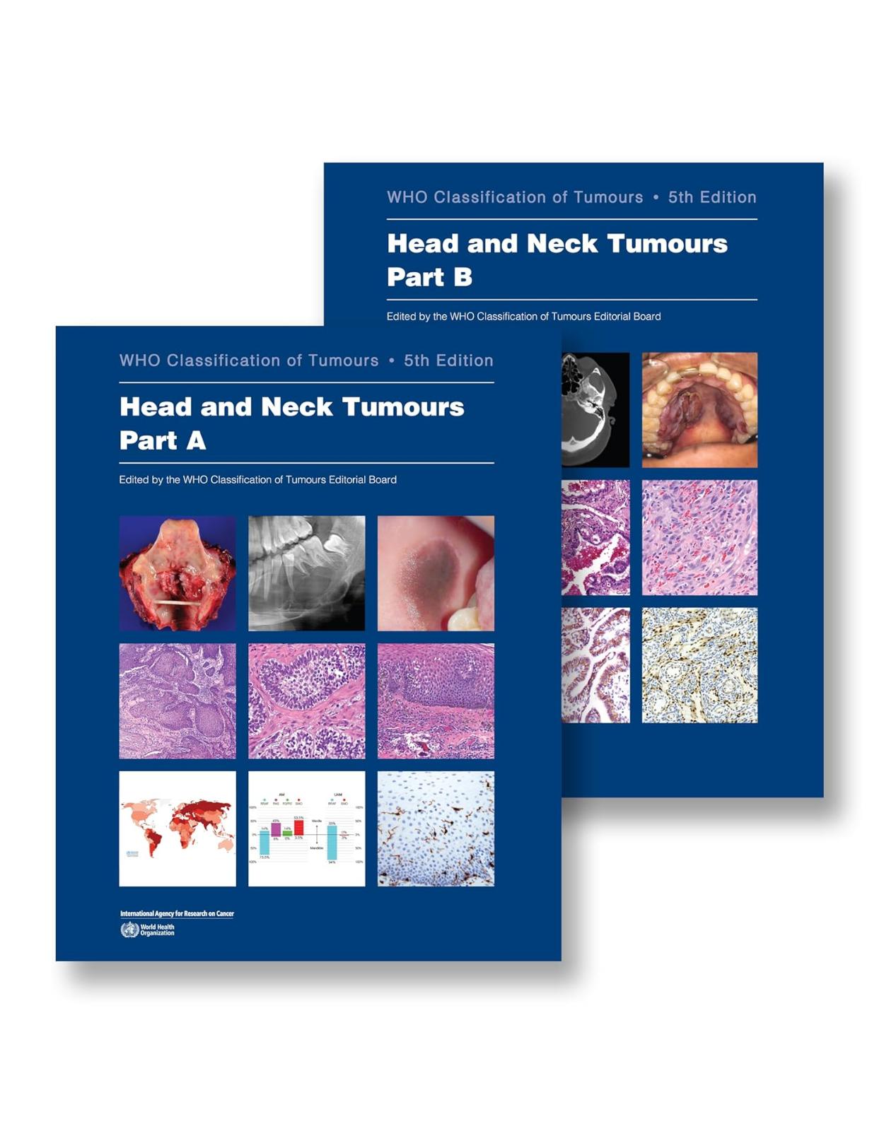 Head and Neck Tumours. WHO Classification of Tumours, 5th Edition, Volume 9