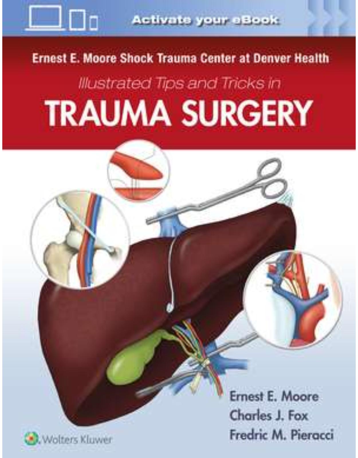 Ernest E. Moore Shock Trauma Center at Denver Health Illustrated Tips and Tricks in Trauma Surgery