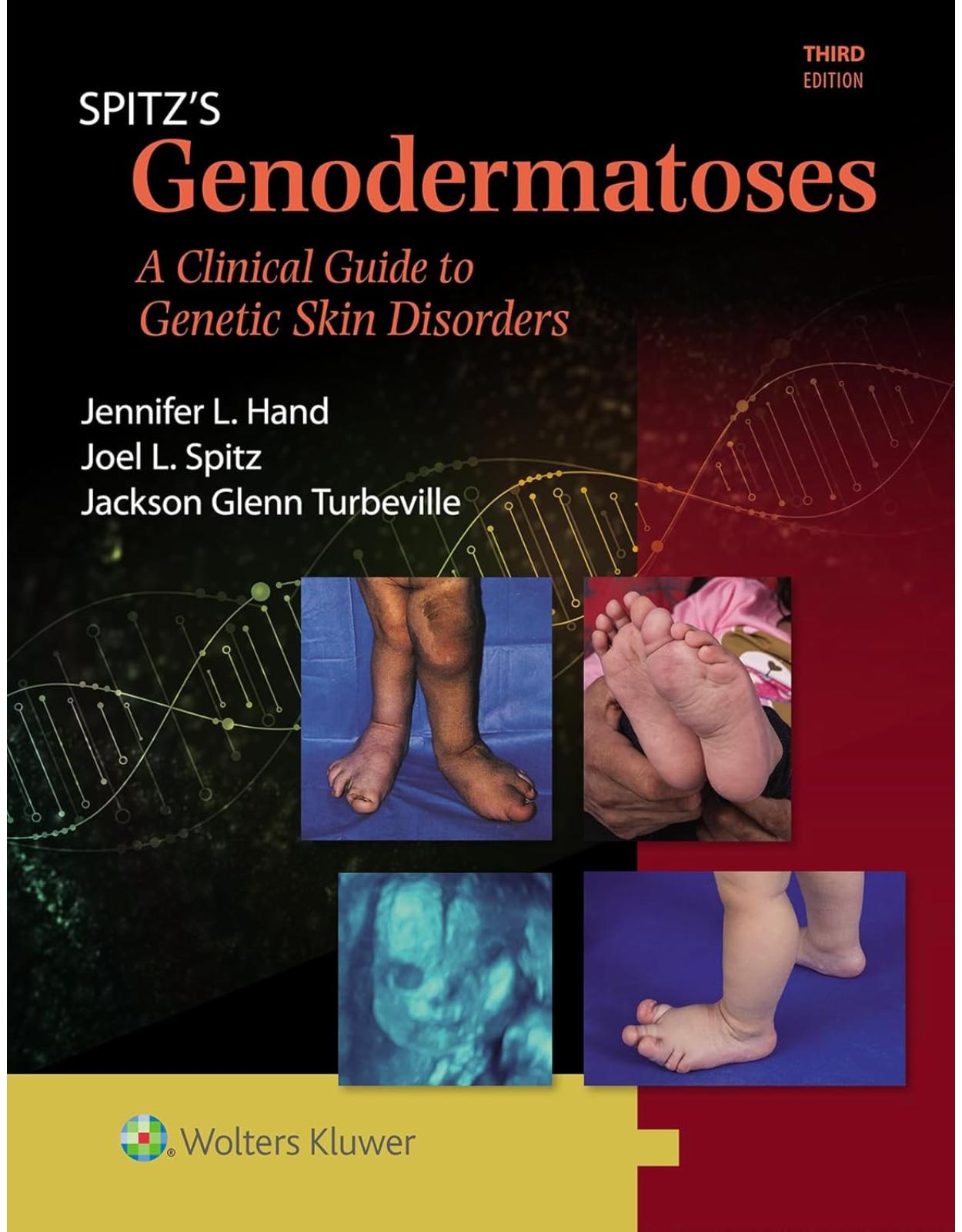 Spitz’s Genodermatoses A Full Color Clinical Guide to Genetic Skin Disorders