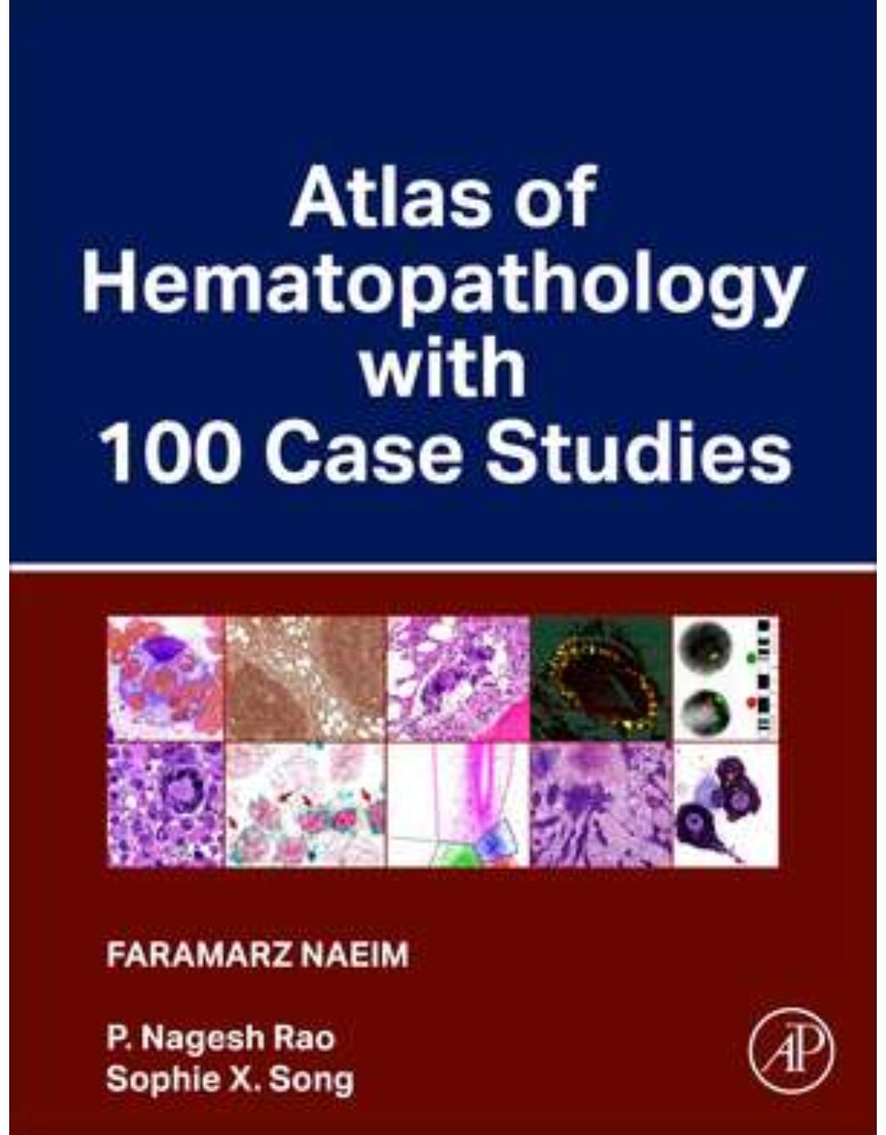 Atlas of Hematopathology with 100 Case Studies