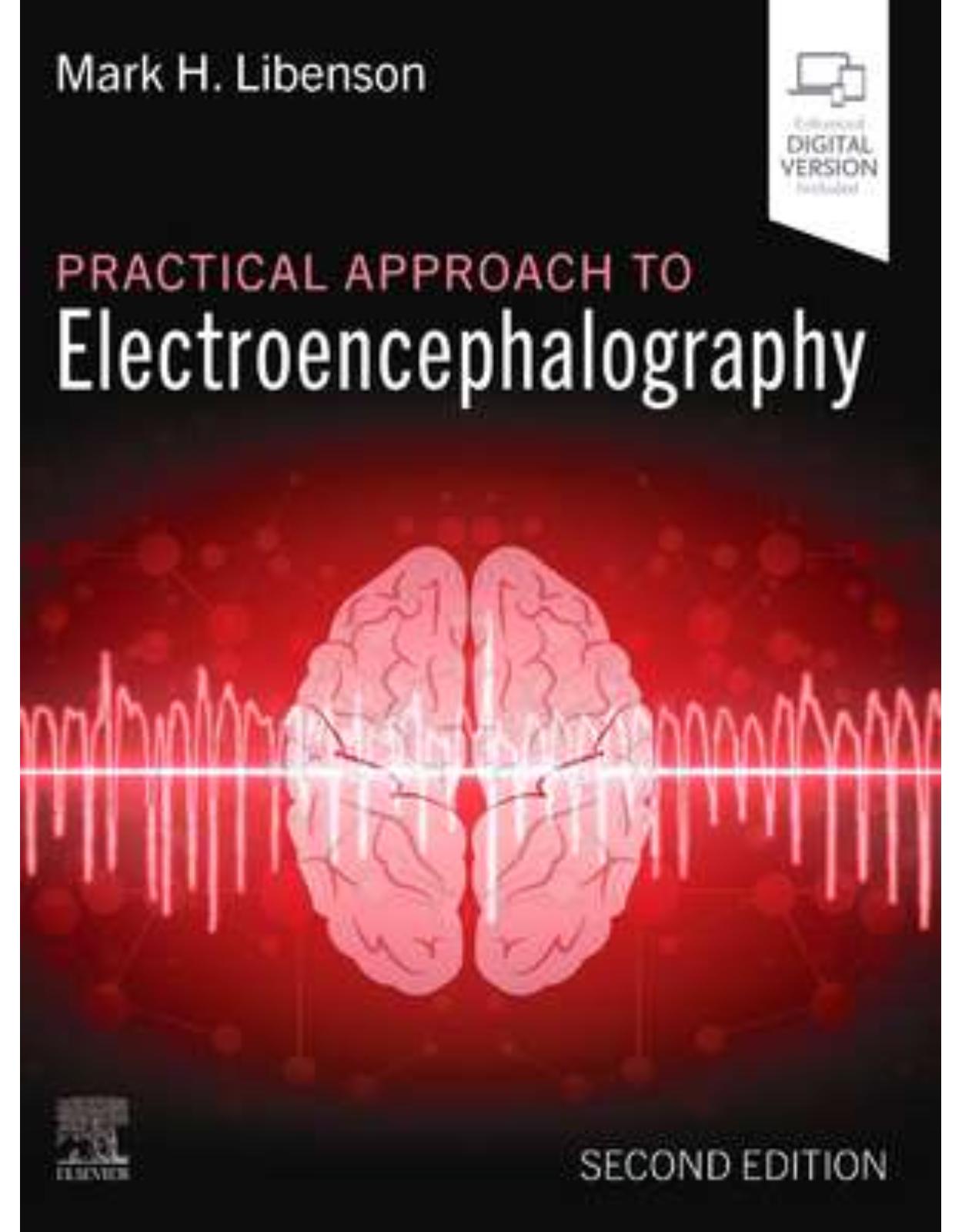 Practical Approach to Electroencephalography