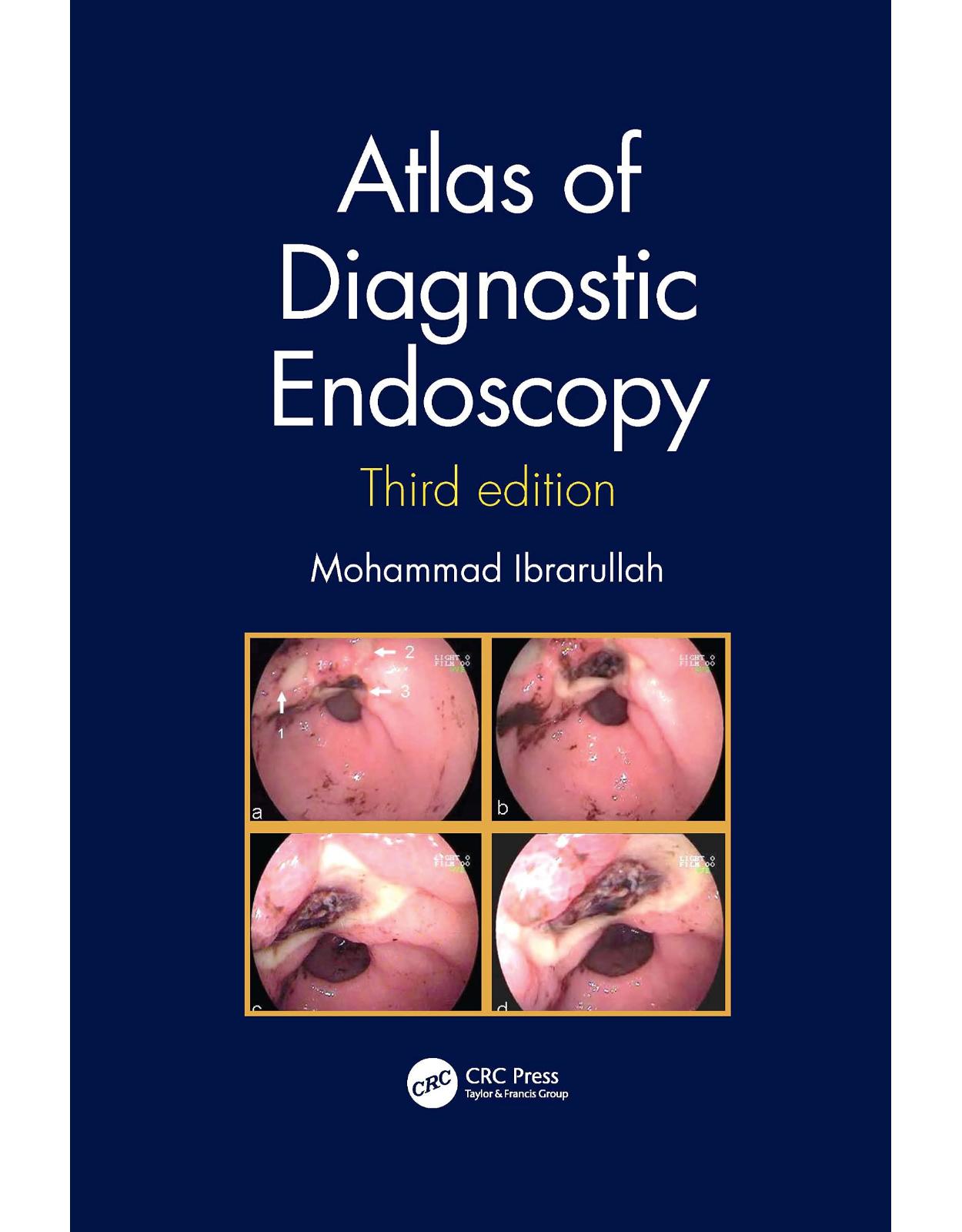 Atlas of Diagnostic Endoscopy, 3E