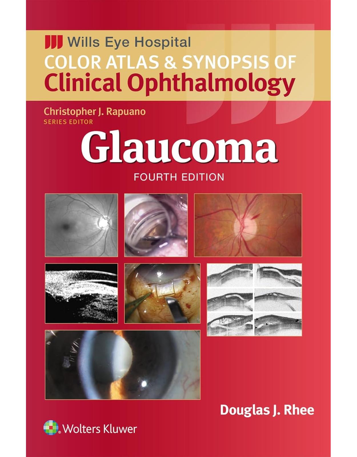 Glaucoma (Wills Eye Institute Atlas Series)