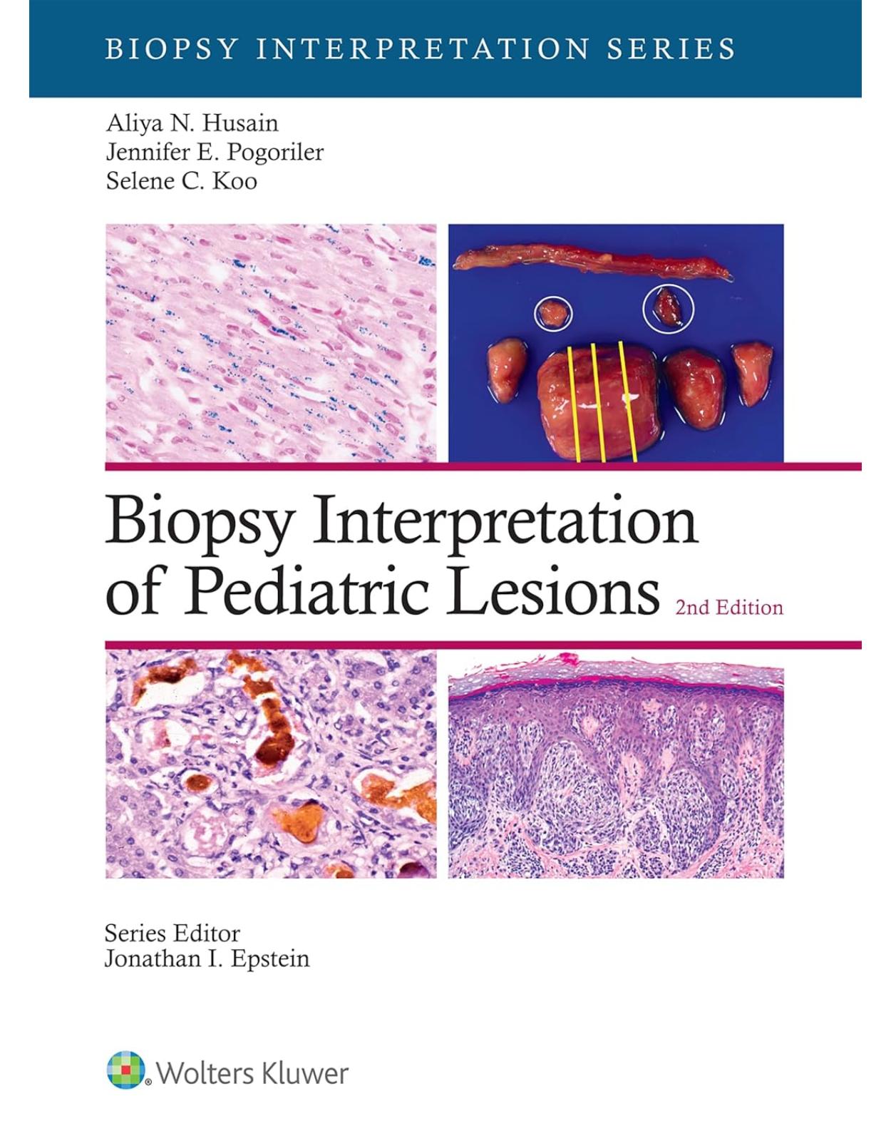 Biopsy Interpretation of Pediatric Lesions