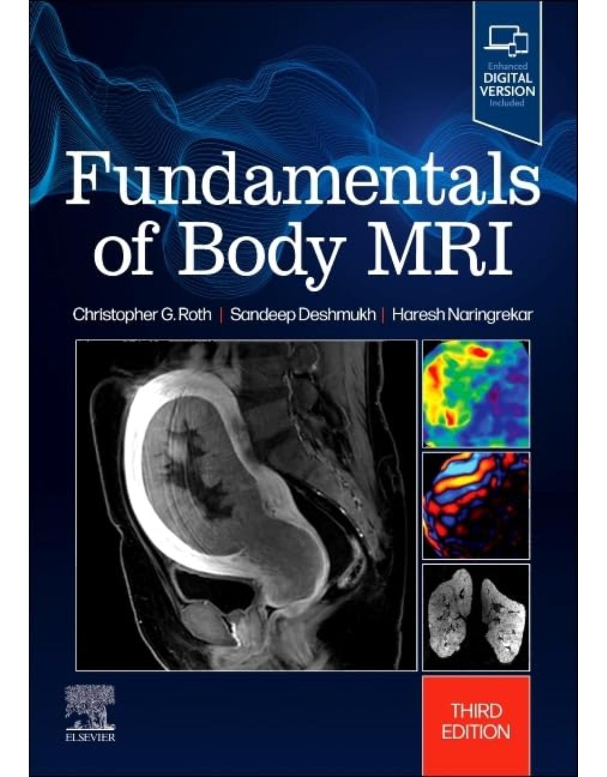 Fundamentals of Body MRI