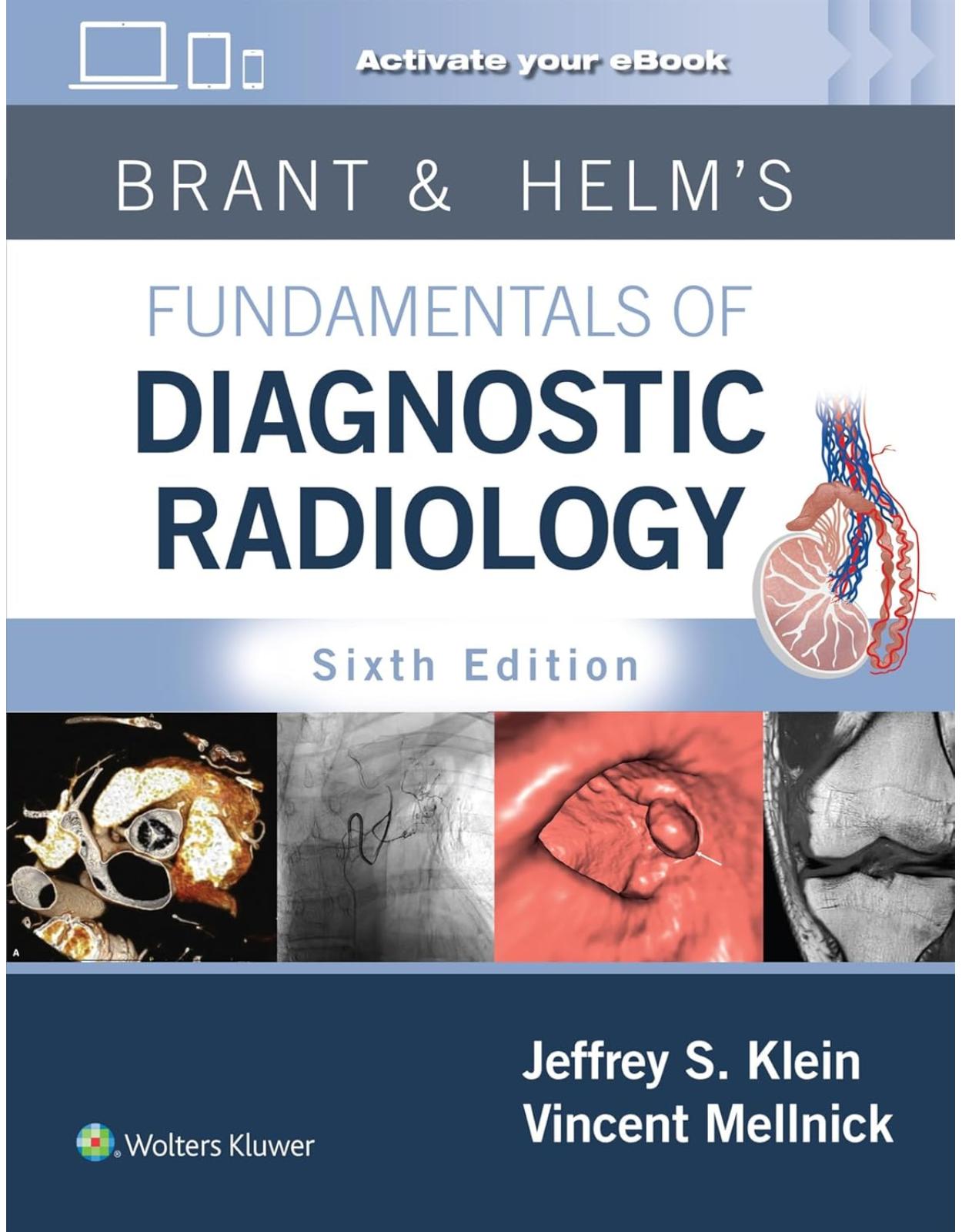 Brant & Helm's Fundamentals of Diagnostic Radiology