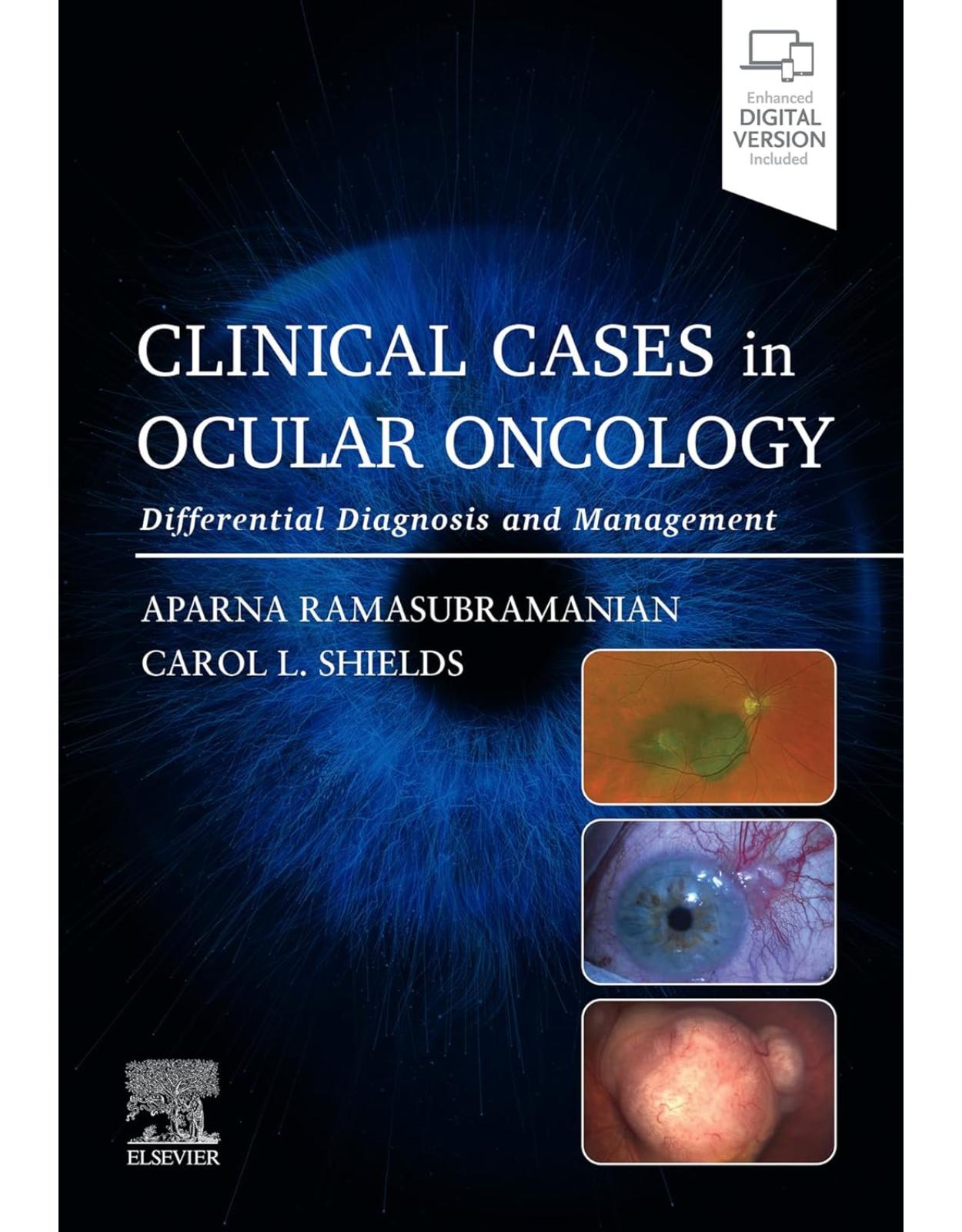 Clinical Cases in Ocular Oncology: Differential Diagnosis and Management