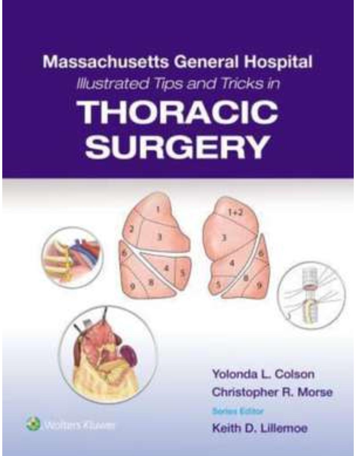 Massachusetts General Hospital Illustrated Tips and Tricks in Thoracic Surgery